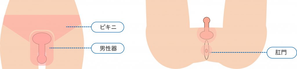 男性VIO脱毛